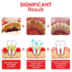 Probiotic Whitening Toothpaste (Pack of 4)