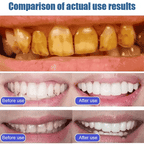 Probiotic Whitening Toothpaste (Pack of 4)