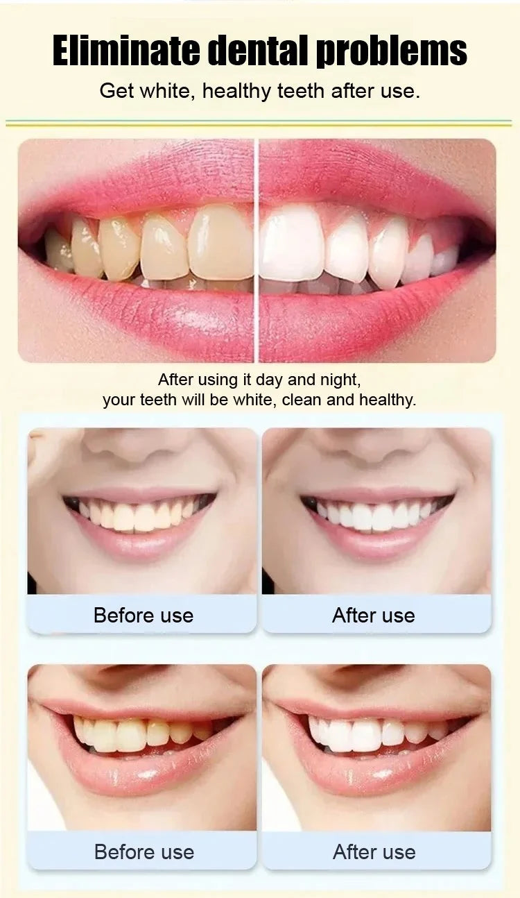 Probiotic Whitening Toothpaste (Pack of 4)