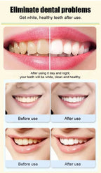 Probiotic Whitening Toothpaste (Pack of 4)